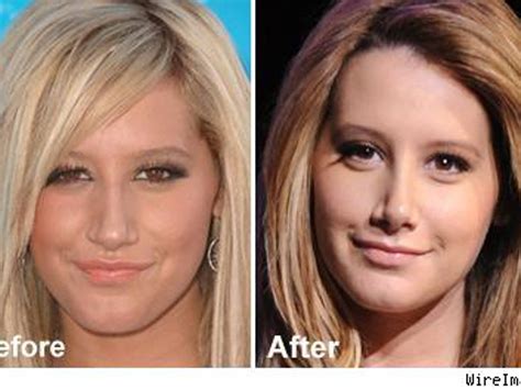 Ashley Tisdale Nose Job Before And After