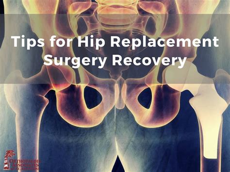 Tips For Hip Replacement Surgery Recovery Orthopaedic Associates Of