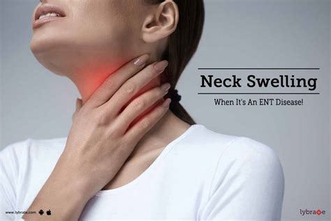 Neck Swelling When It S An Ent Disease By Dr Anjan Jyoti Bhuyan Lybrate
