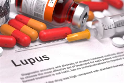 Saphnelo Approved To Treat Systemic Lupus Erythematosus