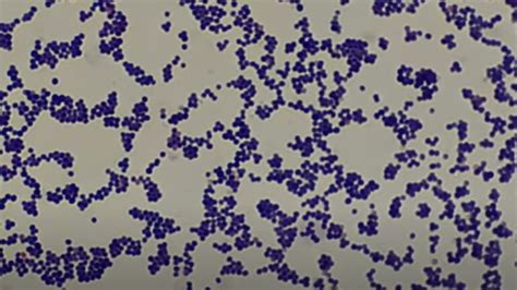 Gram Positive Cocci Gpc Introduction And List Of Bacteria Key