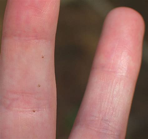 Tiny Seed Ticks Bugguidenet