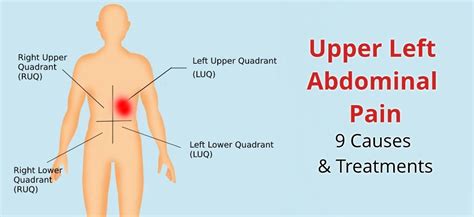 Upper Left Abdominal Pain Possible Causes And Treatment