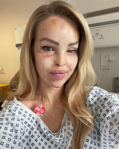 Katie Piper Rushed To Hospital For Emergency Procedure As Oesophagus Closed Up Daily Star