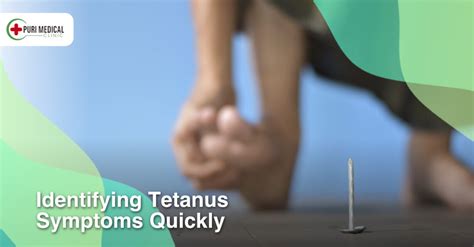 Identifying Tetanus Symptoms Quickly Puri Medical Dentist Bali