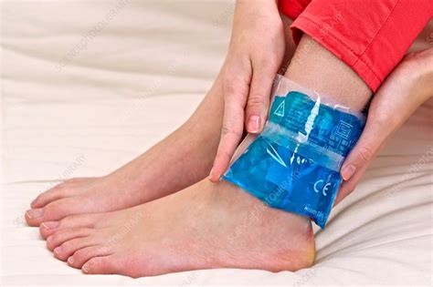 Sprained Ankle Stock Image C0141222 Science Photo Library
