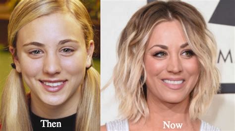 Kaley Cuoco Plastic Surgery Before And After Photos Latest Plastic