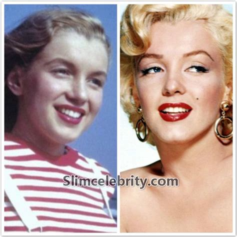 Marilyn Monroe Plastic Surgery Before After