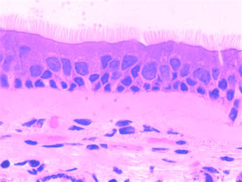The cells that comprise the epithelial membranes are variously shaped and are named accordingly. Pseudostratified