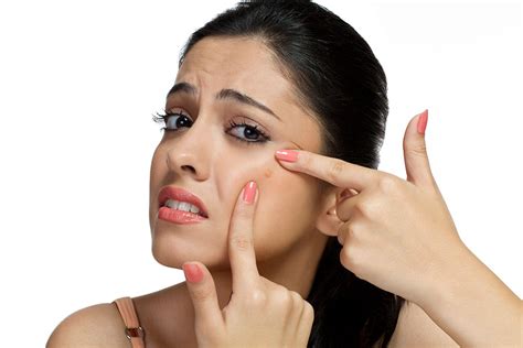 Say Goodbye To Acne Top 10 Skincare Mistakes To Avoid