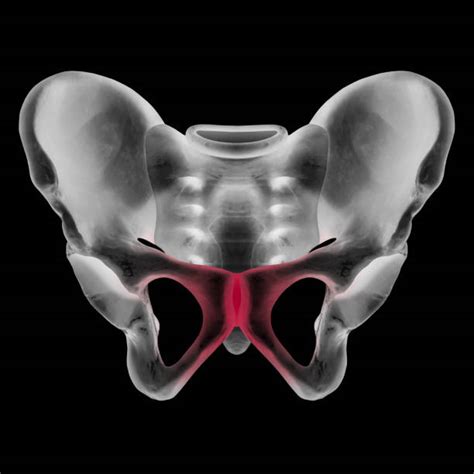Pubic Bone Pic Stock Photos Pictures And Royalty Free Images Istock