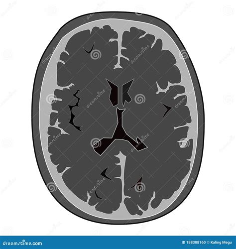 Normal Head On Ct Scans Royalty Free Stock Image