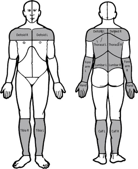 Upper back pain can be due to various reasons such as trigger points, muscle tightness/ shortening, muscle weakness, wrong bio mechanics and poor posture. Template for scoring pain diagrams with focused zones for ...