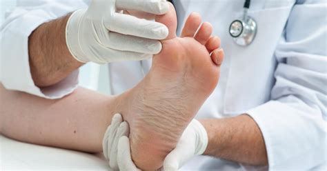Ten Signs Its Time To See A Podiatrist South Shore Health