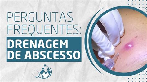 Quanto Custa Uma Drenagem De Abscesso