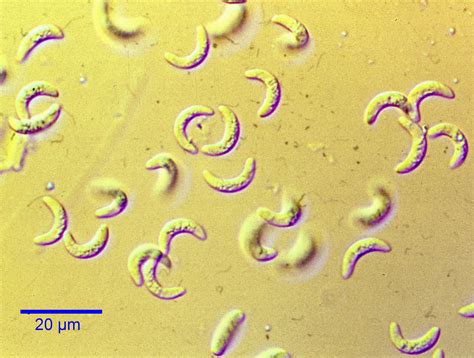 Toxoplasma Gondii Learn About Parasites Western College Of