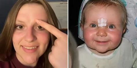Tiktoker Claims Forehead Scar Caused By Eating Her Twin In The Womb Indy100