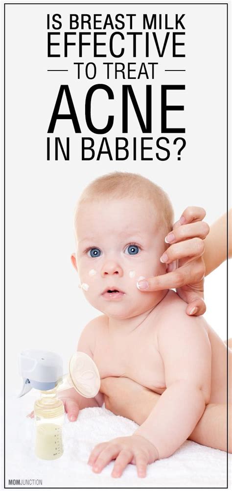 Baby Acne What Causes Them And How You Can Prevent Baby Acne