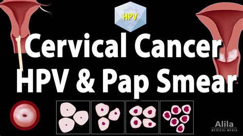 Cervical Cancer HPV And Pap Test Animation YouTube