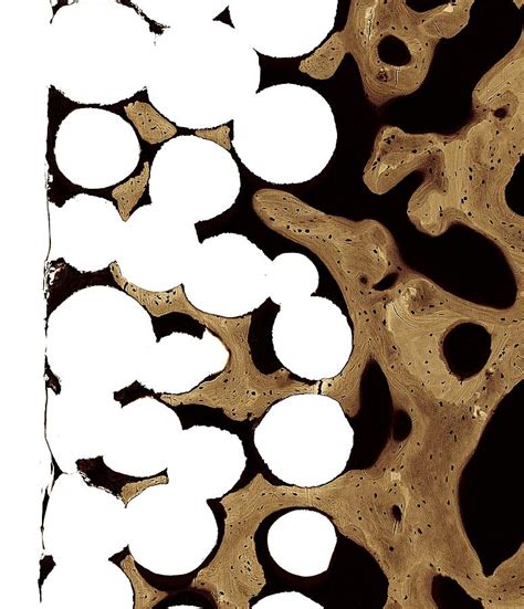 It has a high femur head showing trabecular bone : Bone Cross-section Photograph by Science Photo Library