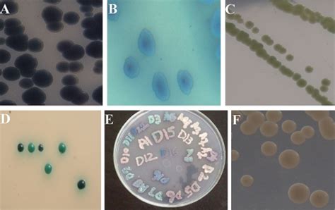 A Candida Tropicalis Bluish Purple Colonies B The Appearance Of C