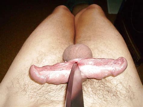 Extreme Modification Of The Penis Pics Xhamster