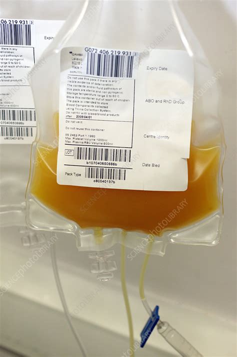 Separated Blood Platelets In A Bag Stock Image C0547892 Science