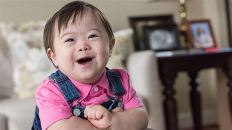Down syndrome (us, canada and other countries) or down's syndrome (uk and other countries) encompasses a number of chromosomal abnormalities, causing highly variable degrees of learning difficulties as well as physical disabilities. Joseph's story: Down Syndrome Awareness month | Texas ...