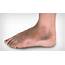 Swollen Ankle And Leg Causes Treatments More