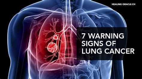What is usually the first sign of lung cancer? 7 WARNING SIGNS OF LUNG CANCER YOU SHOULD NOT IGNORE ...