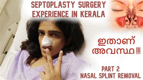 സെപ്റ്റോപ്ലാസ്റ്റി Septoplasty Surgery Experience Part 2 Recovery