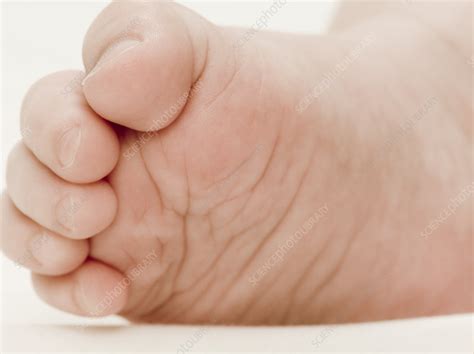 Babys Foot Stock Image M8301808 Science Photo Library