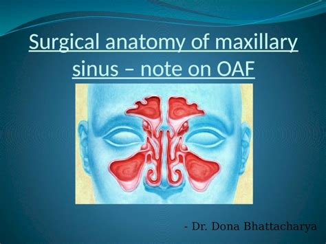 Pptx Surgical Anatomy Of Maxillary Sinus Note On 2 Pdfslidenet