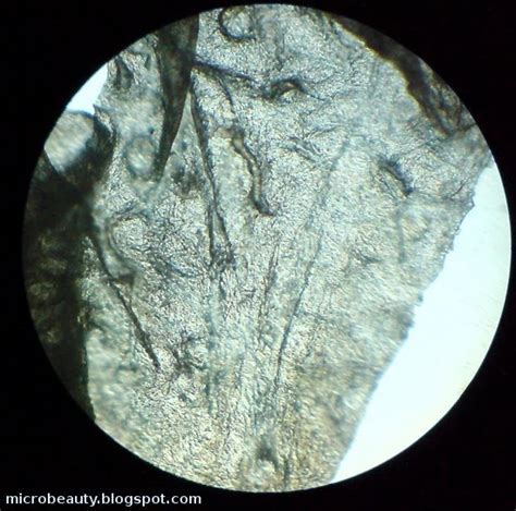 The Wonderful Microworld Micrograph Photos Of Human Skin Surface