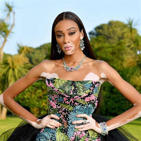 Winnie Harlow Celebrates Her First Vogue Cover Representation Matters
