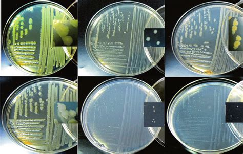The Growth Of Pseudomonas Putida Strain E Isolated From Shoot Cultures