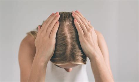 What Does A Healthy Scalp Look Like Biotin Xtreme Hair Care