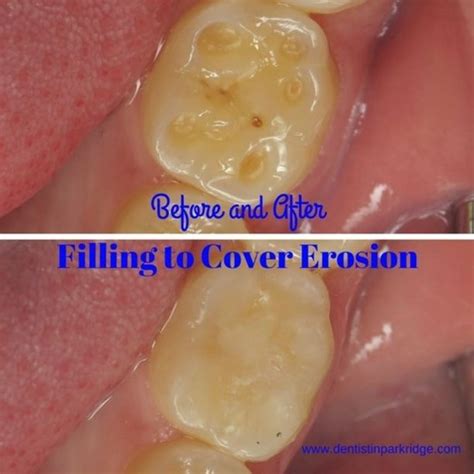 Pin On Davis And Engert Dentistry Before And After