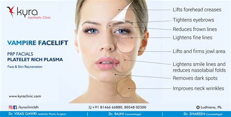 Vampire Facelift Prp For Face Cosmetic Surgery In Ludhiana Plastic Surgery In Punjab Laser