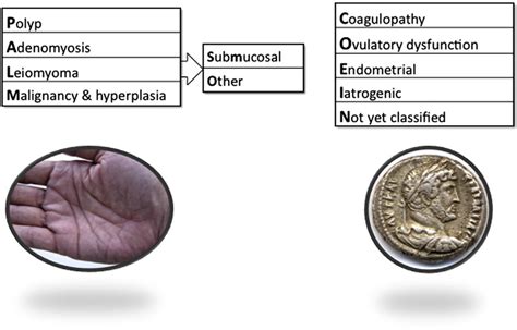 Figo Classification System Palm‐coein For Causes Of Abnormal Uterine Bleeding In Nongravid