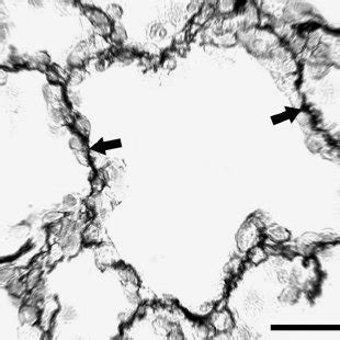 Model of alveolar interdependence. A: Adjoining alveoli equally