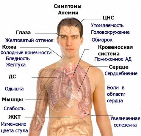Железодефицитная анемия диета какая Железодефицитная анемия: симптомы, лечение, диагностика, причины и Железодефицитная анемия: симптомы, лечение, диагностика, причины и Железодефицитная анемия диета какая