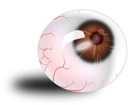 Stroke In Eye 3 Types Causes And Symptoms 2021