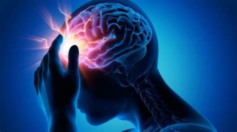 Accidentul Vascular Cerebral AVC Ingrijirea Sanatatii Tratamente