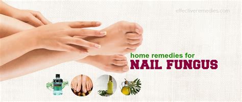 Top 16 Natural Home Remedies For Nail Fungus Removal
