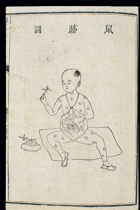 Chinese C18 Paediatric Pox Rat Tracks Pox Wellcome Collection