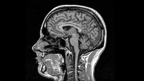 Brain Scans Technologies That Peer Inside Your Head