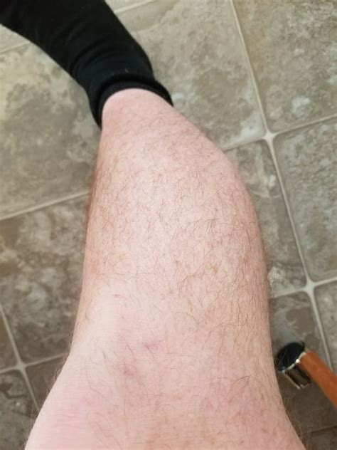 Top 176 How To Get Leg Hair Polarrunningexpeditions