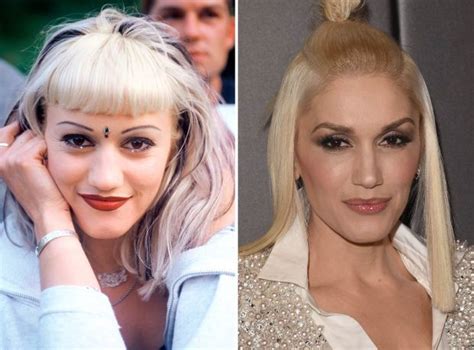 Gwen Stefani Before And After Celebrity Surgery Plastic Surgery Gwen Stefani Plastic Surgery