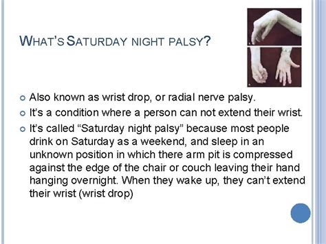 Saturday Night Palsy Whats Saturday Night Palsy Also